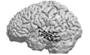 The anatomical structures involved in distraction-related processing in the auditory domain were investigated using magnetoencephalography.