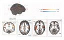 The current study used functional magnetic resonance imaging (fMRI) to investigate the neural basis of musical phrase boundary processing during the perception of music from native and non-native cultures.
