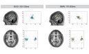 Changes in the pitch of repetitive sounds elicit the mismatch negativity (MMN) of the event-related brain potential (ERP). There exist two alternative accounts for this index of ...