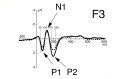 In two experiments with event-related potentials (ERPs), we investigated the formation of auditory Gestalts. For this purpose, we used tone sequences of different structure. In the first experiment, we contrasted a rhythmic ...