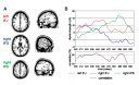 Cognitive control processes enable us to adjust our behavior to changing environmental demands. Although neuropsychological studies suggest that the critical cortical region for cognitive control is ...