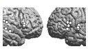 In this chapter, we report a number of studies applying magnetoencephalography (MEG) to the investigation of the modes of human communication. We seek to elucidate the ...