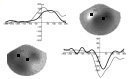 Sensory feedback plays a major role in movement execution and motor learning, particularly in motor rehabilitation. Whilst elaborating therapeutic strategies, it is of interest to visualize the effect of a therapeutic intervention ...