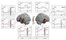 We studied auditory sentence comprehension using magnetoencephalography while subjects listened to sentences whose correctness they had to judge subsequently. ...