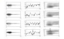 We investigated the early ("preattentive") cortical processing of voice information, using the so-called "mismatch response". This brain potential allows inferences to be made about the ...