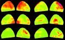 The study investigated the neuronal basis of the retrieval of words from the mental lexicon. The semantic category interference effect was used to locate lexical retrieval processes in time and space. This effect reflects the finding that, for overt naming, ...