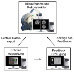 Diagramm zeigt den Prozess der MRT-Bildaufnahme, Echtzeitauswertung und Feedback-Erzeugung.