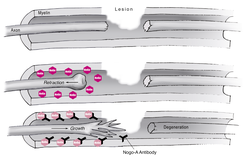 Scheme of the Nogo-A Antibody effect. Top: spinal cord lesion. Middle: Nogo-A inhibits nerve growth. Bottom: nerve sprouting due to antibody effect.