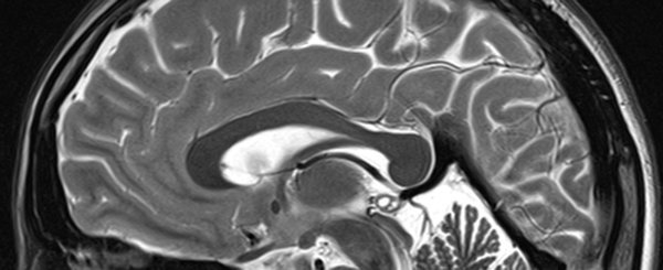 Department of Neurology Department of Neurology