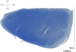 Detailed histological section stained in blue, illustrating the complex cellular architecture, with scale indicators and directional labels visible.