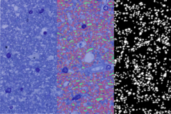 Three-panel image showing cellular structures in different visual styles: axonal cytoplasm in white, myelin sheaths in grey, background in black.