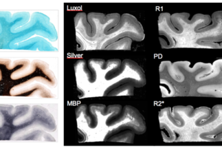Differences in cortical and white matter myelination