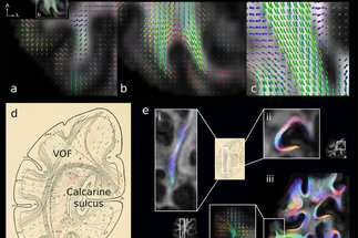 A multi-modal approach to in vivo U-fibre mapping in the early visual processing stream