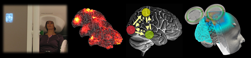 Brain Networks