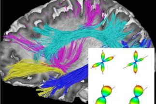 Deterministic and Probabilistic Tractography based on Complex Fiber Orientation Distributions