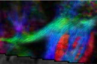 High Resolution Tractography Based on Ultra High Field Diffusion MRI
