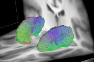 Gray matter parcellation based on local diffusion properties