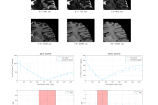 <span>Diffusion properties in cortical grey matter using inversion recovery diffusion weighted imaging</span>