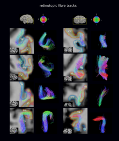 The scientists made a representative subset of the short white matter fibers visible connecting the lower and higher visual cortical areas in the brain.