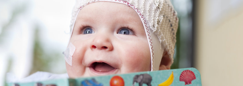 Baby mit EEG-Haube und Buch