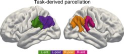 When it comes to language comprehension, the anterior IPL in the left hemisphere of the brain is of importance (green). For attention, it is the anterior IPL in the right side of the brain (pink). If, on the other hand, social skills are required, the posterior parts of the IPL in both hemispheres of the brain spring into action simultaneously (orange, purple).