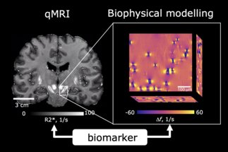 Teaser image for MRI biophysics