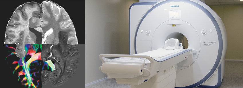 This figure presents an MRI image of the human brain showing from different contrasts, each highlighting different structures in the brain.