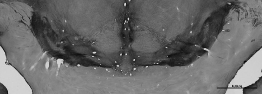 Image showing the nigrosomes in the substantia nigra in tissue obtained from a donor without Parkinson's disease