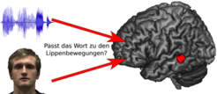 Ein Areal im linken Sulcus temporalis superior (STS) reagierte mit erhöhter Aktivität, wenn beim Lippenlesen die Mundbewegung nicht mit erwarteten Wörtern zusammenpasste.
