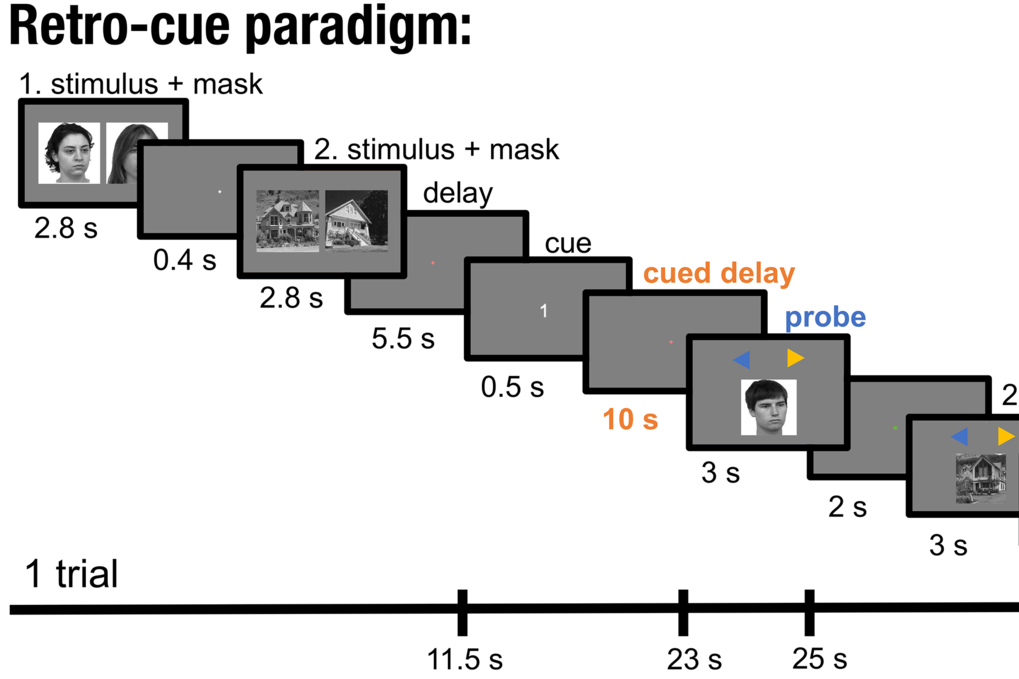 Illustriert den zeitlichen Verlauf des Retro-cue Paradigmas.