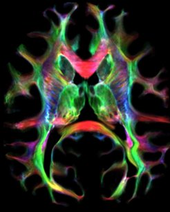 3D-Abbildung der komplexen Nervenfaserstrukturen des Schimpansengehirns