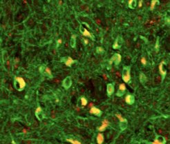 Using magnetic resonance imaging with microscopic resolution, the scientists measured minute magnetic field perturbations around each cell (yellow).