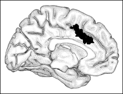 In schwarz die Gehirnregion, in der für Musik Langzeiterinnerung spezifische Informationen verarbeitet werden.