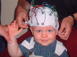 Electrodes on the surface of the head register electrical signals emanating from the nerve cells and transmit them to the measuring instruments.