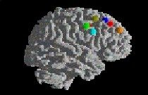 Grey brain model with colored areas on a black background.