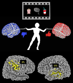 Der sogenannte Sulcus temporalis superior (STS) im Schläfenlappen ist für die Interpretation positiver Ereignisse zuständig. Der sogenannte Lobus parietalis inferior (IPL) im Scheitellappen wird hingegen aktiv, wenn wir sie als negativ empfinden.