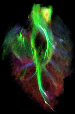 The connectivity of the cerebellum. © Christopher J. Steele/ MPI CBS