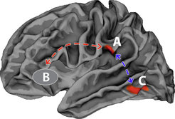 There are two crucial changes in children’s brain structure: They have a thinner cortex, especially in region A, and their fibre tracts between two important language areas (A and B) which act as a kind of data highway to transport the information between these two brain areas are less developed. © MPI CBS