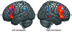 Broca’s area, restricted to the left hemisphere, is centrally involved in language processing. Now, scientists at MPI CBS have learned that the equivalent area, in the right hemisphere (red), plays a similar role but for the processing of music. More specifically, it’s activated when we notice violations of musical grammar. The areas in blue are typically associated with working memory and show increased brain activity when the grammar gets longer and more complicated (A - anterior, P - posterior). © Scientific Reports